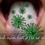 Bệnh nấm lưỡi ở trẻ