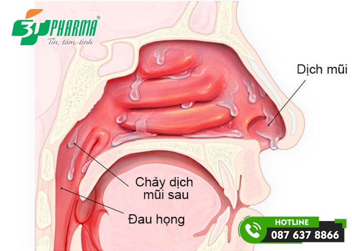 ho sau cúm A kéo dài do dịch mũi chảy vào họng - 3T Pharma