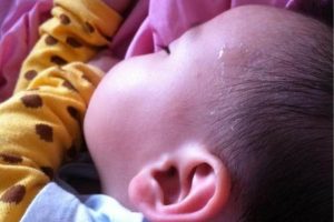 Mồ hôi trộm thường ra ở phần đầu của trẻ