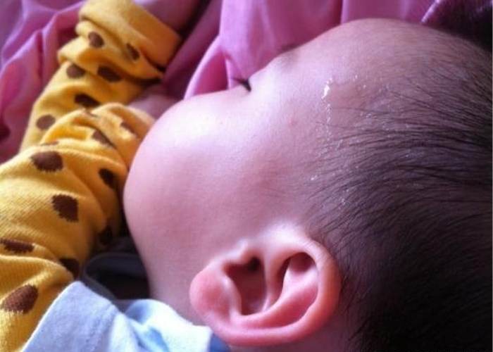 Mồ hôi trộm thường ra ở phần đầu của trẻ