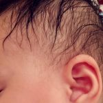 Cháu rất hay ra mồ hôi ở đầu khi ngủ, buổi đêm tôi phải dùng đến 4-5 khăn vải màn để lau mồ hôi mà khăn nào cũng ẩm xì xì