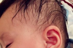 Cháu rất hay ra mồ hôi ở đầu khi ngủ, buổi đêm tôi phải dùng đến 4-5 khăn vải màn để lau mồ hôi mà khăn nào cũng ẩm xì xì