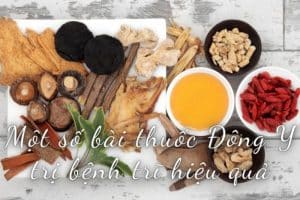 bài thuốc Đông Y trị bệnh trĩ