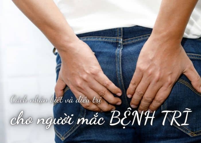 bệnh trĩ nội
