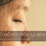 Đổ mồ hôi trộm là bệnh gì?