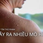 thủ phạm gây ra nhiều mồ hôi