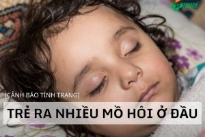trẻ ra mồ hôi trộm ở đầu khi ngủ