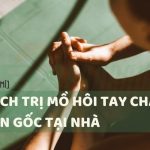 trị mồ hôi tay chân tận gốc tại nhà