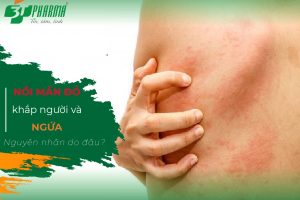 Nổi mụn ngứa ở khắp người - Nguyên nhân do đâu?