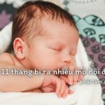 Bé 11 tháng bị ra nhiều mồ hôi đầu