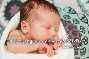 Bé 11 tháng bị ra nhiều mồ hôi đầu