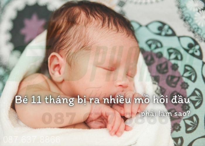 Bé 11 tháng bị ra nhiều mồ hôi đầu