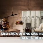 mẹo chữa dị ứng mẩn ngứa tại nhà