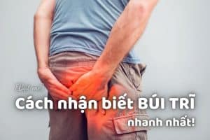 Cách nhận biết BÚI TRĨ
