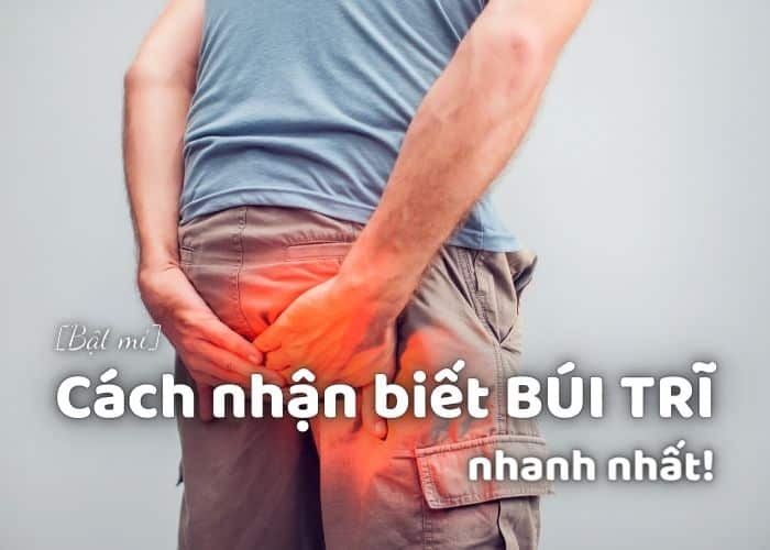 Cách nhận biết BÚI TRĨ