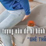 Ai dễ bị bệnh trĩ