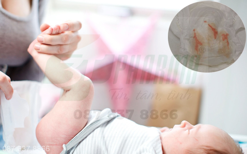 Nguyên nhân đi ngoài ra máu ở trẻ đang bú mẹ