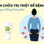 Cách chữa trị triệt để bệnh trĩ