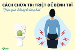 Cách chữa trị triệt để bệnh trĩ