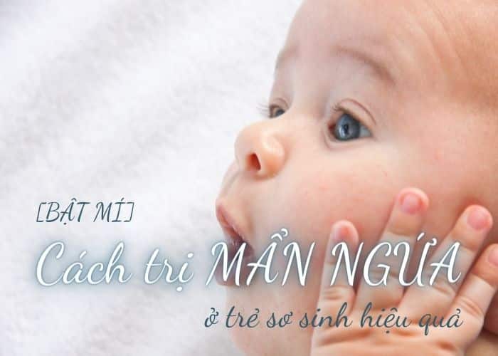 Cách trị mẩn ngứa ở trẻ sơ sinh