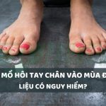 ra mồ hôi tay chân vào mùa đông