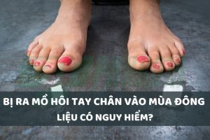 ra mồ hôi tay chân vào mùa đông