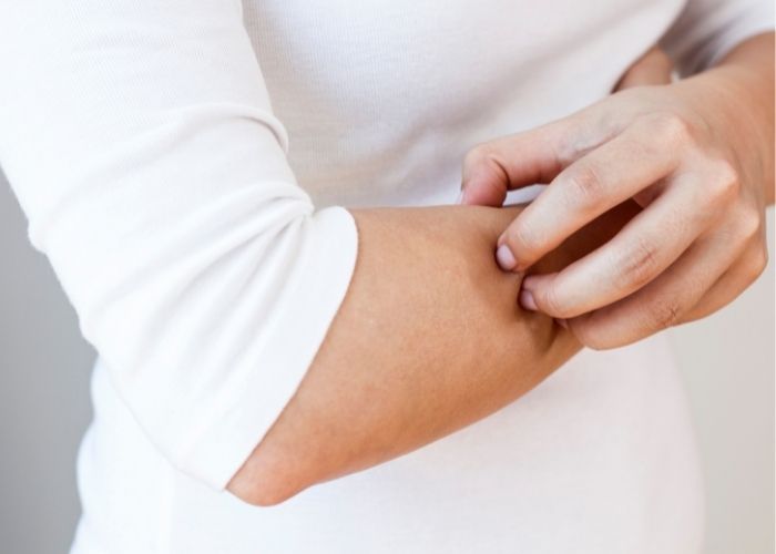 nguyên nhân gây ngứa da, bị ngứa da là bệnh gì, căng thẳng bị ngứa, cách điều trị ngứa ngoài da, trị ngứa ngoài da, các loại mẩn ngứa ngoài da, hay bị ngứa da, cách trị ngứa ngoài da, da ngứa, các bệnh ngứa về da, bị ngứa da toàn thân là bệnh gì, da bị lở ngứa, các loại ngứa ngoài da, bị ngứa ngoài da là bệnh gì