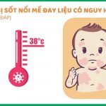 Trẻ bị sốt nổi mề đay