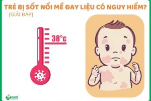 Trẻ bị sốt nổi mề đay