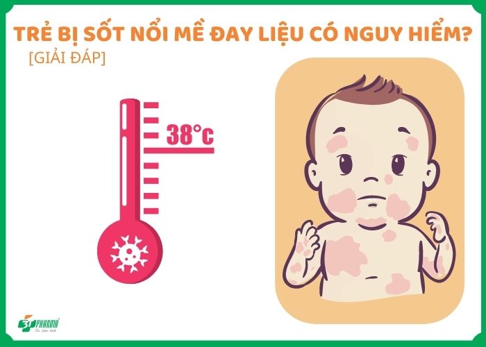 Trẻ bị sốt nổi mề đay
