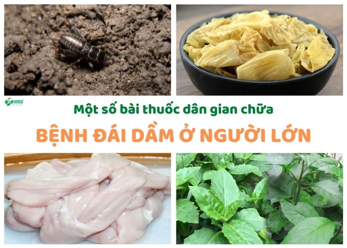 Một số mẹo chữa đái dầm ở người lớn hiệu quả