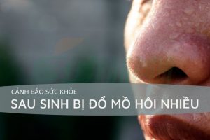 Sau sinh bị đổ mồ hôi nhiều