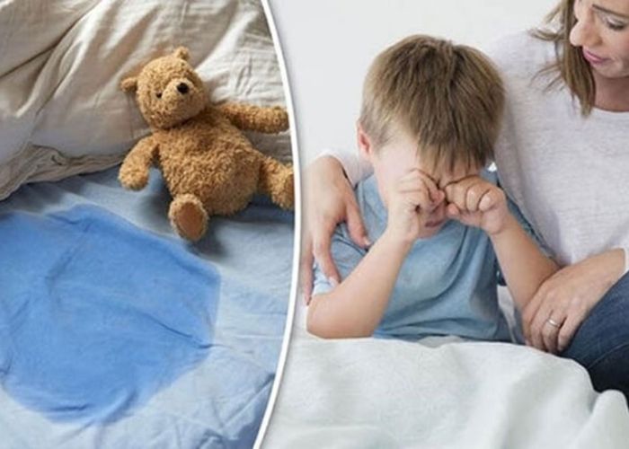 Tình trạng đái dầm kéo dài sẽ khiến trẻ cảm thấy xấu hổ, tự ti 