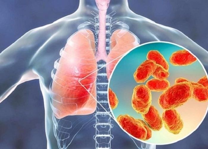 Ho khan kéo dài nếu không sớm được điều trị sẽ dẫn đến ung thư phổi 