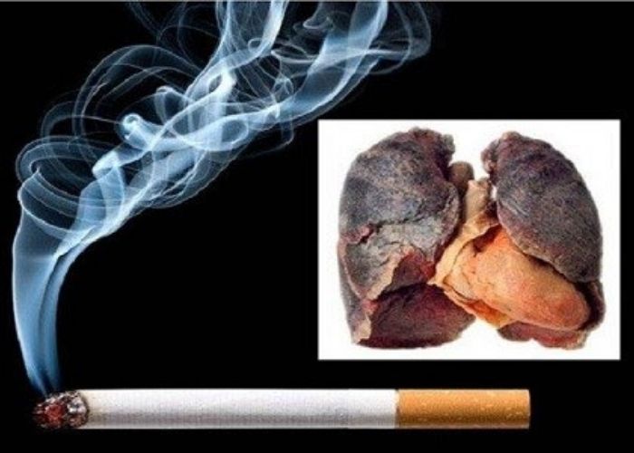 Khói thuốc độc hại từ thuốc là nguyên nhân hàng đầu dẫn đến viêm thanh quản mãn tính 