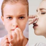  Chảy máu cam không cầm được phải làm thế nào?