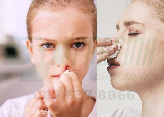  Chảy máu cam không cầm được phải làm thế nào?