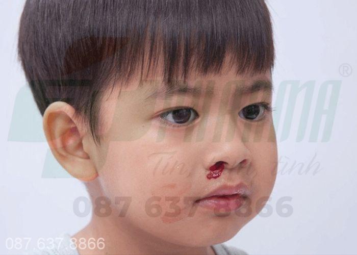 Chảy máu cam (chảy máu mũi) xuất hiện khi các mạch máu mũi bị tổn thương