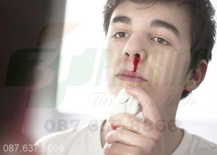 Chảy máu cam có thể xuất hiện ở bất kỳ nhóm đối tượng nào 