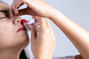 Hiện tượng chảy máu cam liên tục liệu có nguy hiểm không?