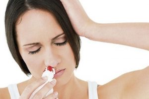 Chảy máu cam nhiều có bị gì không? Dấu hiệu cảnh báo sức khỏe bạn