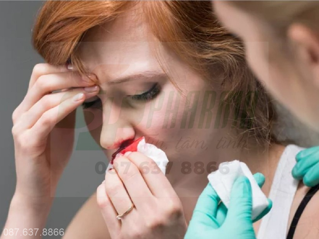bị chảy máu cam thường xuyên là bệnh gì, Chảy máu cam kèm theo đau đầu, choáng váng là tình trạng y tế nguy hiểm