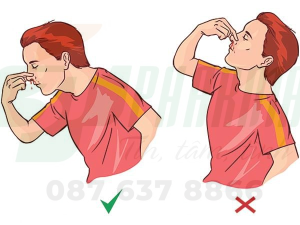 Sơ cứu chảy máu cam đúng cách giúp cầm máu hiệu quả, bị chảy máu cam thường xuyên là bệnh gì