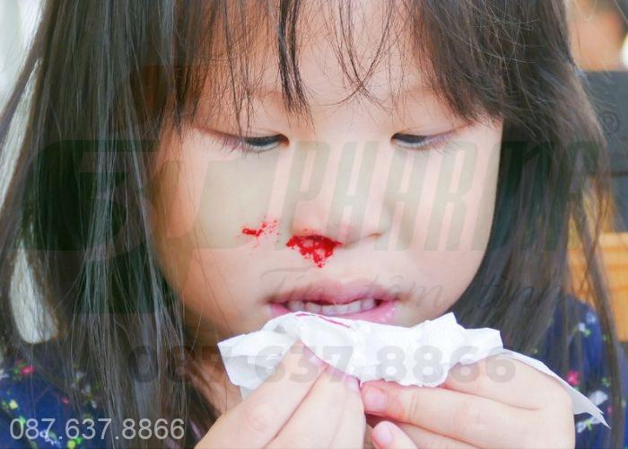 Chảy máu cam 1 bên mũi phải 