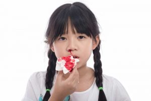 Cách cầm máu khi bị chảy máu cam