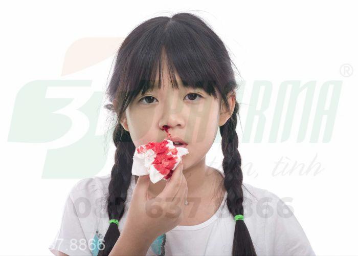 Cách cầm máu khi bị chảy máu cam