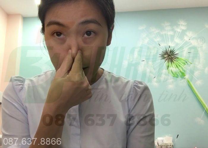 Sơ cứu cầm máu khi xảy ra chảy máu cam chóng mặt