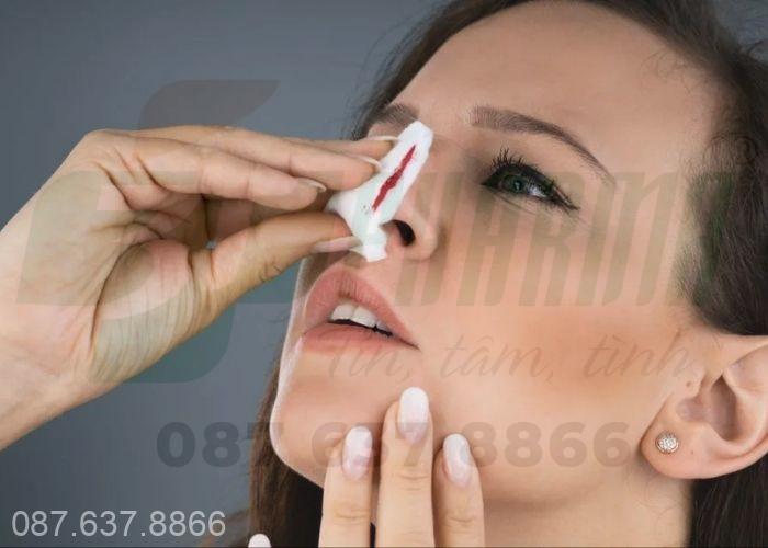 Ngửa cổ lên khi bị chảy máu cam là một sai lầm 