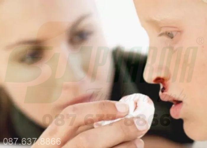 Chảy máu cam có thể là dấu hiệu cảnh báo bạn mắc phải một bệnh lý nào đó 