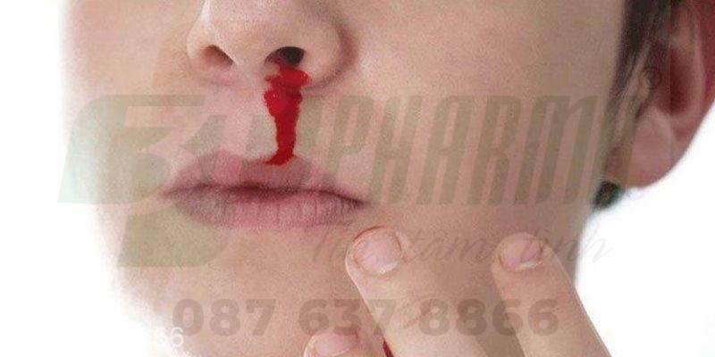 Chảy máu cam là bệnh lý khá thường gặp ở nhiều đối tượng